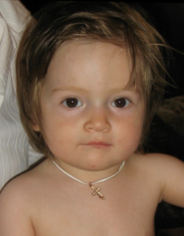 Фоторафия донора CMP-DO-3070